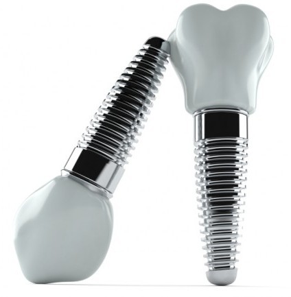 Dental Implants - Stratford, NJ