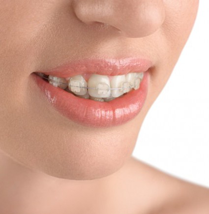 Orthodontics | Stratford Dental Center